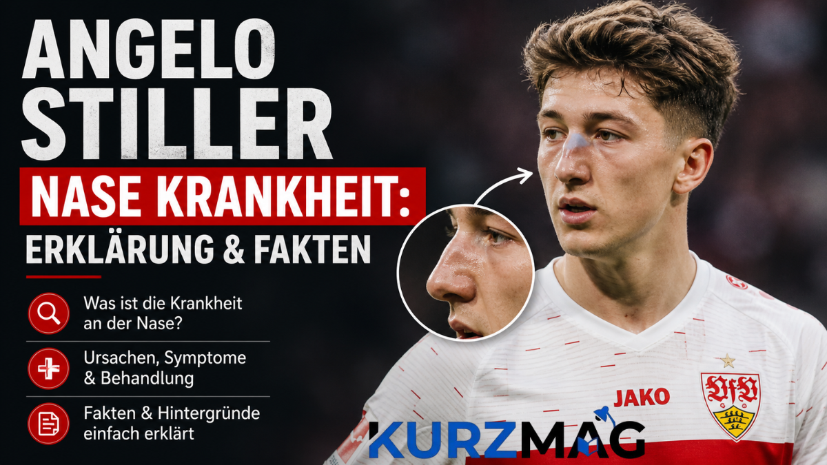 Angelo Stiller Nase